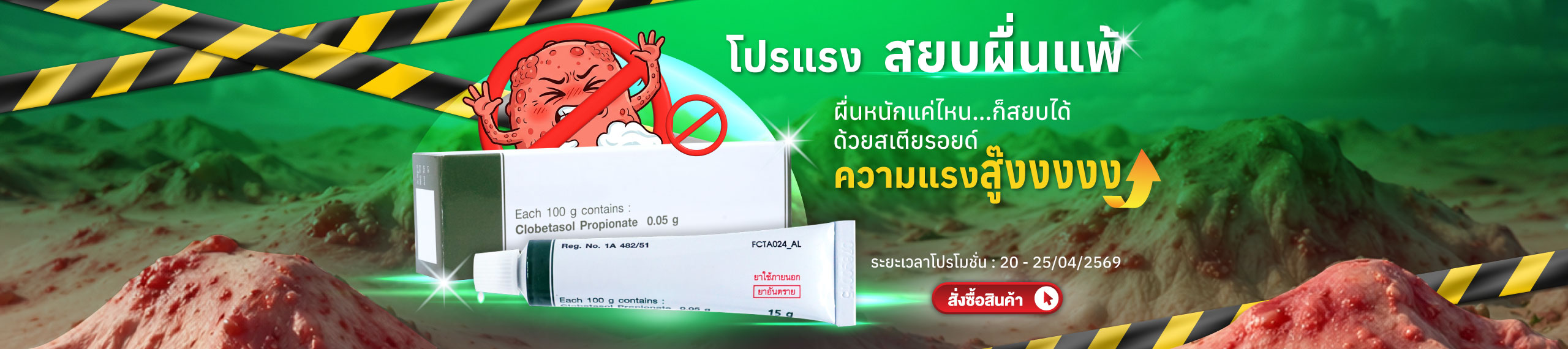 สยบผื่นแพ้